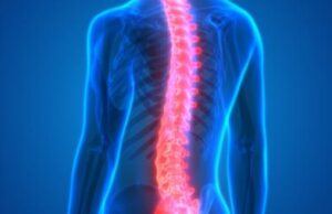 MS research MS bed for multiple sclerosis